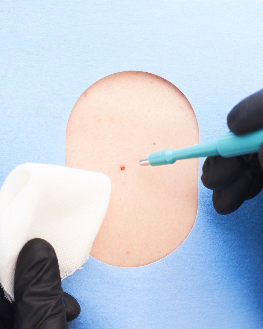Dermatology